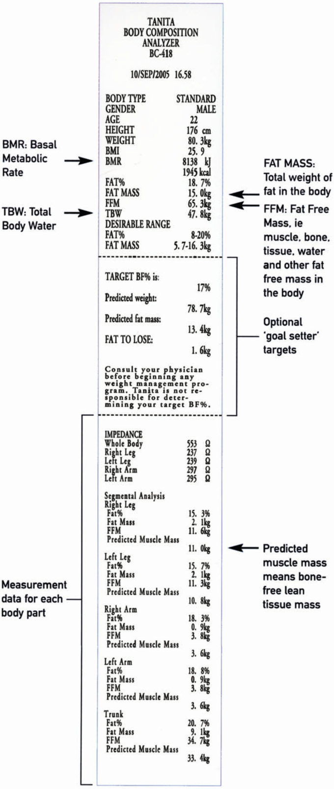 Tanita BC418 MA Floor Standing Segmental Body Composition Analyser